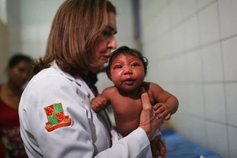 Tiến sỹ Angela Roch, chuyên gia về bệnh truyền nhiễm ở trẻ nhỏ, đang xét nghiệm cho một bé 2 tháng tuổi mắc chứng đầu nhỏ. (Nguồn: Reuters)