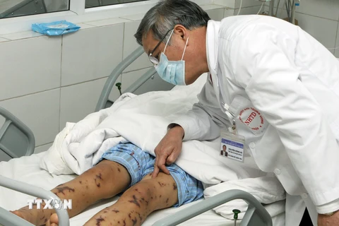 Bác sỹ Bệnh viện Bệnh Nhiệt đới Trung ương kiểm tra sức khỏe cho bệnh nhân viêm não mô cầu hồi năm 2012. Ả tư liệu. (Ảnh: Dương Ngọc/TTXVN)