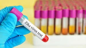 Bộ Y tế: 200 mẫu bệnh phẩm xét nghiệm virus Zika âm tính 