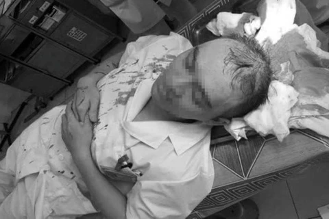 Bác sỹ Dương sau khi bị người nhà của bệnh nhân nhi hành hung. (Ảnh: Bệnh viện cung cấp)
