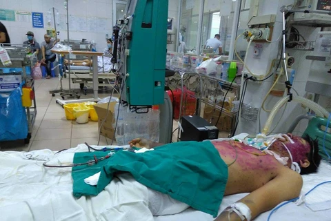 Bệnh nhân mắc thủy đậu đang được điều trị tại Bệnh viện Bệnh Nhiệt đới Trung ương. (Ảnh: PV/Vietnam+)