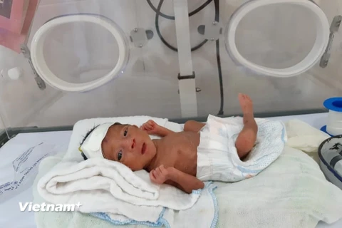 Trẻ sơ sinh nặng 900g được nuôi dưỡng thành công tại Bệnh viện Đa khoa huyện Bắc Hà. (Ảnh: PV/Vietnam+)