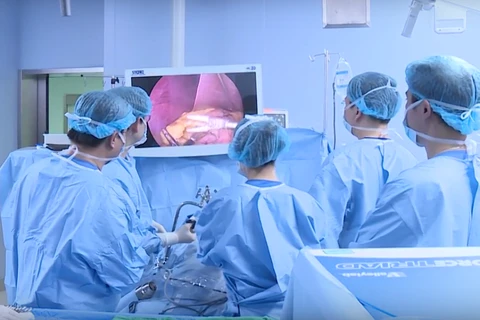 Các bác sỹ phẫu thuật nội soi thu nhỏ dạ dày hình ống để điều trị bệnh béo phì. (Ảnh: PV/Vietnam+)