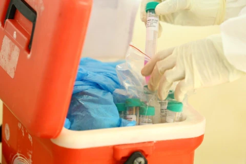 Các mẫu bệnh phẩm chuyển đến các đơn vị xét nghiệm bằng phương pháp RT-PCR. (Ảnh: Minh Quyết/TTXVN)