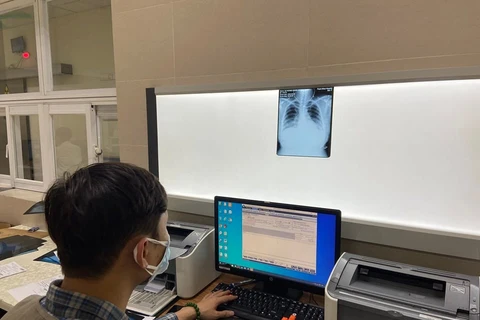 Bác sỹ xem phim chụp phổi cho một bệnh nhân hậu COVID-19. (Ảnh: PV/Vietnam+)
