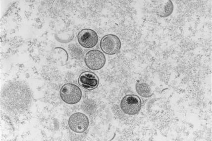 Hình ảnh virus đậu mùa khỉ dưới kính hiển vi. (Ảnh: AFP/TTXVN)