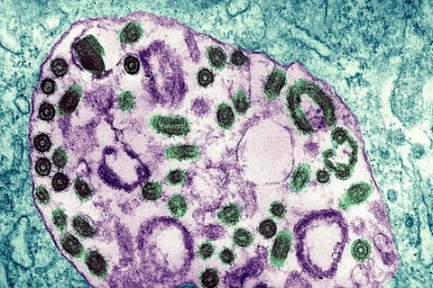 Virus Marburg khiến nhiều người ở Guinea Xích đạo tử vong. (Nguồn: Getty Images)