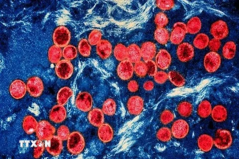 Hình ảnh virus đậu mùa khỉ dưới kính hiển vi. (Ảnh: Getty Images/TTXVN)