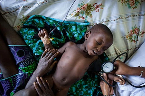 Thế giới ghi nhận 63 triệu ca tử vong ở trẻ em trong năm 2013
