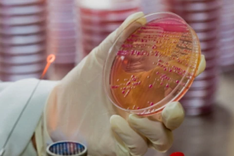 Phát hiện siêu vi khuẩn kháng thuốc gây chết người tại Australia