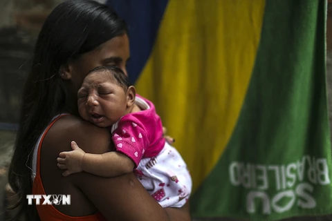 Em bé 1 tháng tuổi mắc chứng đầu nhỏ tại Rio de Janeiro, Brazil. (Nguồn: EPA/TTXVN)