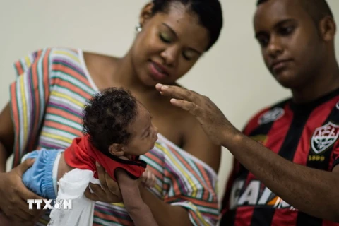 Trẻ sơ sinh mắc dị tật đầu nhỏ do nhiễm virus Zika điều trị tại một bệnh viện ở Salvador, Brazil. (Nguồn: AFP/TTXVN)