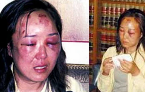 Bà Zhao Yan bị đánh dã man do bị nhầm là một tay buôn lậu ma túy. (Nguồn: shanghaiist.com)