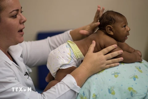 Một em bé bị mắc chứng đầu nhỏ do virus zika được điều trị tại bệnh viện ở Salvador, Brazil. (Nguồn: AFP/TTXVN)