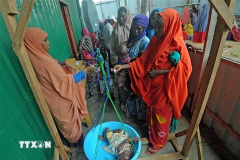 Trẻ em bị suy dinh dưỡng điều trị tại một trung tâm y tế ở ngoại ô Mogadishu, Somalia. (Ảnh: AFP/TTXVN)