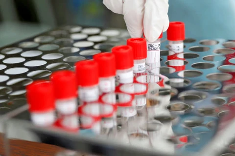 Các mẫu xét nghiệm SARS-CoV-2. (Nguồn: Reuters)