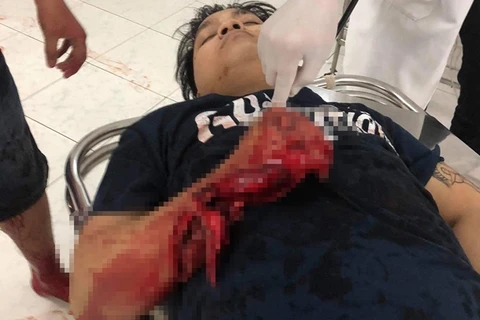 Nạn nhân bị chém gây thương tích nặng. (Nguồn: cand.com.vn)