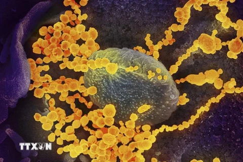Hình ảnh virus SARS-CoV-2 (màu vàng) nổi lên bề mặt tế bào người. (Ảnh: AFP/TTXVN)