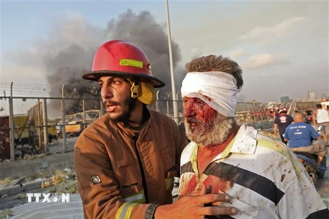 Nạn nhân bị thương trong vụ nổ. (Ảnh: AFP/TTXVN)