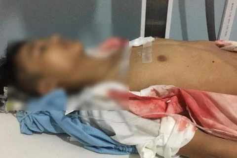 Hà Giang: Nam sinh bị bạn đâm thấu ngực ngay trước cổng trường