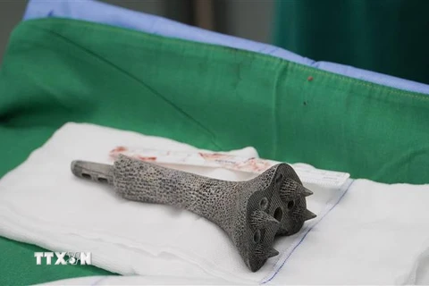 Mảnh ghép 3D hợp kim titanium dạng tổ ong dùng để thay thế cho đoạn xương bị mất của bệnh nhân. (Ảnh: TTXVN phát)