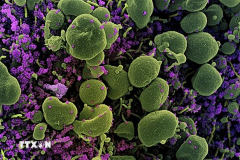 Hình ảnh quét qua kính hiển vi điện tử cho thấy tế bào (màu xanh) bị virus SARS-COV-2 (màu tím) xâm nhập. (Ảnh: AFP/TTXVN)