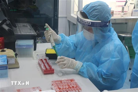 Xét nghiệm phát hiện SARS-CoV-2 bằng kỹ thuật RT-PCR. (Ảnh: Bích Huệ/TTXVN)