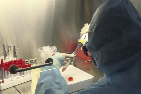  Cán bộ Trung tâm Kiểm soát bệnh tật làm xét nghiệm các mẫu bệnh phẩm nghi ngờ nhiễm virus SARS-CoV-2. (Ảnh: TTXVN)