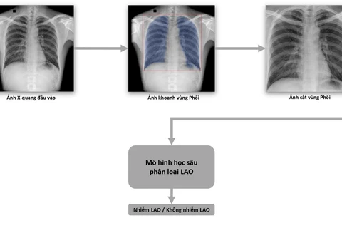 Quy trình dạy máy phân loại bệnh Lao. (Nguồn: Vingroup)