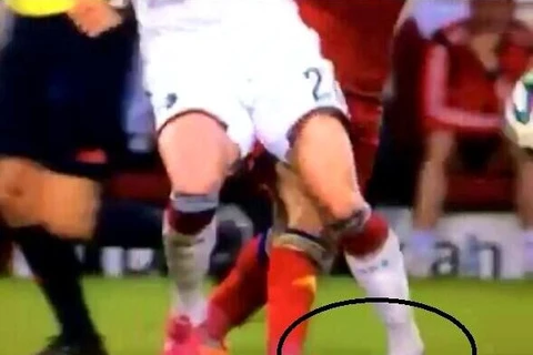 [Video] Cận cảnh pha chấn thương ghê rợn của Marco Reus