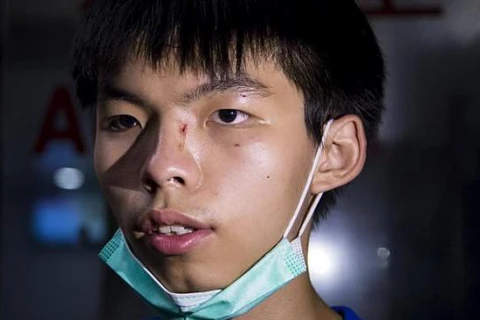 Thủ lĩnh sinh viên Hong Kong Joshua Wong bị kẻ lạ mặt tấn công