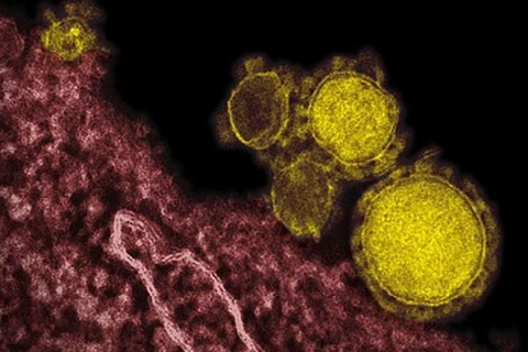 Thêm trường hợp nhiễm và tử vong do virus MERS