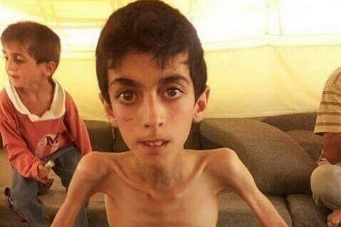 Một cậu bé gầy guộc ở Syria. (Nguồn: news.qq.com)