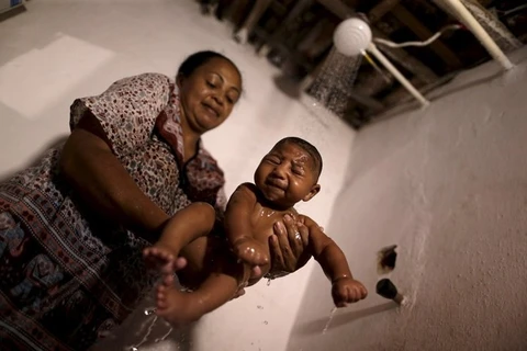 Người mẹ đang bế con trai mắc chứng đầu nhỏ do virus Zika gây ra. (Nguồn: Reuters)