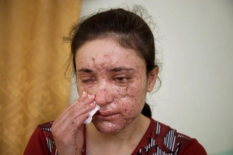 Ký ức đau thương của cô gái 18 tuổi làm nô lệ tình dục cho IS