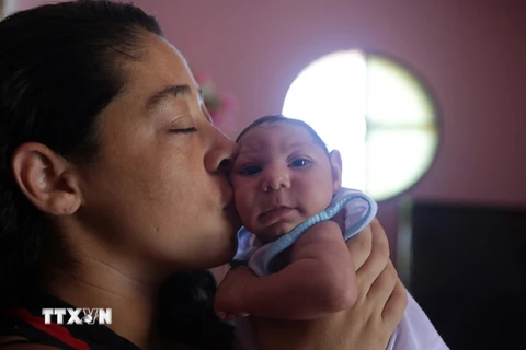 Một trẻ sơ sinh bị mắc căn bệnh đầu nhỏ do mẹ bị nhiễm virus Zika khi mang thai tại Rio de Janeiro ngày 4/2. (Nguồn: THX/TTXVN)