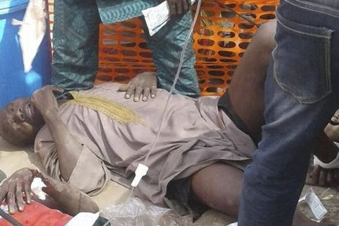Một người bị thương trong cuộc không kích nhầm. (Nguồn: AFP/MSF)