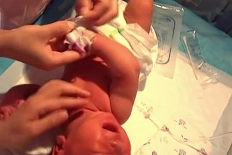 Em bé được chăm sóc tại bệnh viện. (Nguồn: sctv.com)