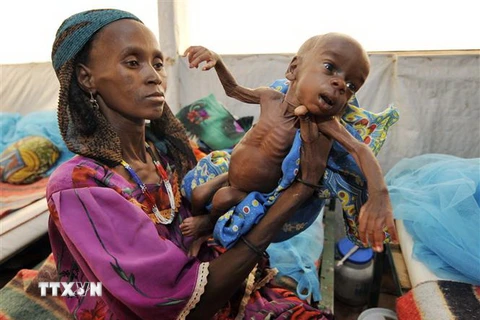 Trẻ em bị suy dinh dưỡng tại Tanout, Nam Niger. (Nguồn: AFP/TTXVN) 