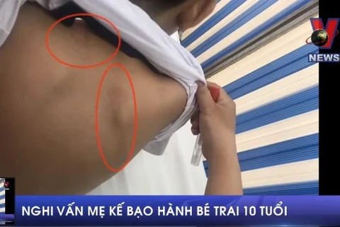 [Video] Làm rõ nghi vấn mẹ kế bạo hành bé trai 10 tuổi