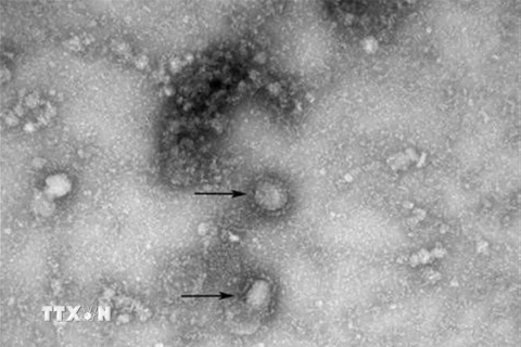 Virus corona mới, được cho là nguyên nhân gây ra dịch viêm phổi lạ tại Vũ Hán, Trung Quốc. (Nguồn: Yonhap/TTXVN) 