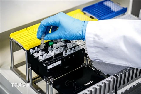 Kỹ thuật viên xét nghiệm mẫu bệnh phẩm COVID-19 trong phòng thí nghiệm tại Roosendaal, Hà Lan, ngày 4/3/2020. (Nguồn: AFP/TTXVN) 