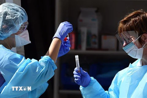 Nhân viên y tế kiểm tra mẫu bệnh phẩm của bệnh nhân nhiễm COVID-19 tại một cơ sở thí nghiệm ở San Francisco, bang California ngày 12/3/2020. (Nguồn: AFP/TTXVN) 