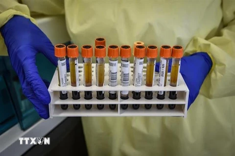 Các mẫu bệnh phẩm COVID-19 được sử dụng để nghiên cứu vắcxin phòng ngừa dịch tại bệnh viện Spallanzani ở Rome, Italy. (Nguồn: ANSA/TTXVN) 