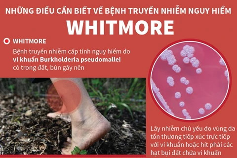 [Infographics] Những điều cần biết về căn bệnh nguy hiểm Whitmore