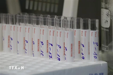 Công đoạn gộp mẫu nâng công suất xét nghiệm tại phòng nhận và xử lý mẫu tại CDC Phú Yên. (Ảnh: Phạm Cường/TTXVN)