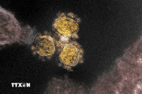 Hình ảnh quét qua kính hiển vi điện tử cho thấy virus SARS-COV-2 trên mẫu bệnh phẩm của bệnh nhân COVID-19. (Ảnh: AFP/TTXVN) 