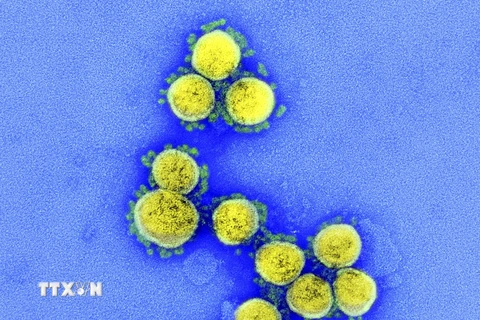 Hình ảnh từ kính hiển vi do Viện Y tế quốc gia Mỹ cung cấp cho thấy virus SARS-CoV-2 trong mẫu bệnh phẩm của bệnh nhân mắc COVID-19 ở Mỹ. (Ảnh: AFP/TTXVN) 