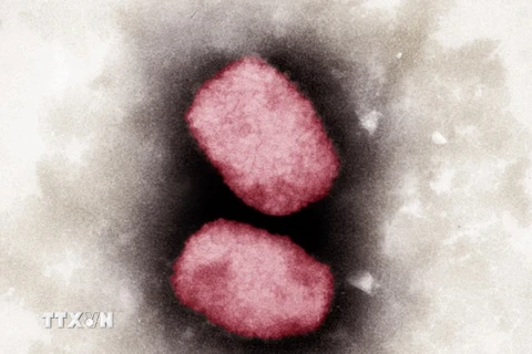 Virus đậu mùa khỉ nhìn dưới kính hiển vi. (Ảnh: AFP/TTXVN) 