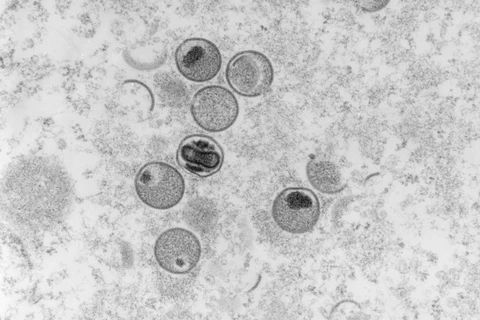 Hình ảnh virus đậu mùa khỉ dưới kính hiển vi điện tử tại phòng thí nghiệm thuộc Viện nghiên cứu và kiểm soát bệnh truyền nhiễm Robert Koch của Đức, ngày 23/5/2022. (Ảnh: AFP/TTXVN) 